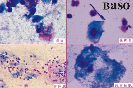 �D�ư׎�ͿƬȾɫҺ