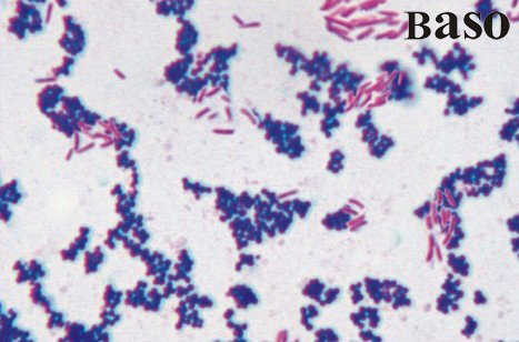 ���m��ȾɫҺ