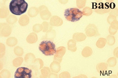 ��������(x��)���A������øȾɫҺ��NAP��