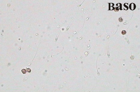 ��Һ�׼�(x��)���^������øȾɫԇ���У����ױ�������