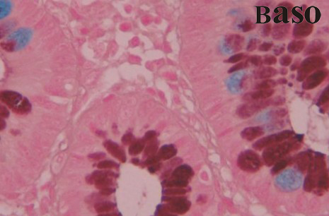 ���F����-�����{(l��n)(HID-AB)ȾɫҺ